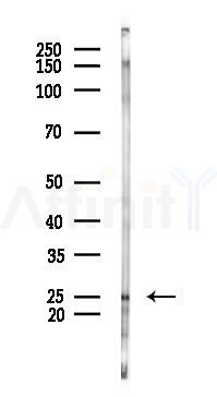 ATP6V1E1 Antibody - Western blot analysis of lysates from Rat liver, using ATP6V1E1 Antibody at 1/1000 dilution.