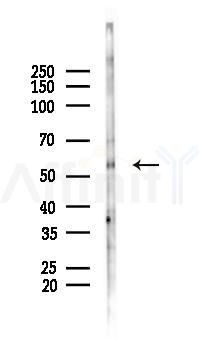 Kv1.6 Antibody - Western blot analysis of lysates from Mouse brain, using Kv1.