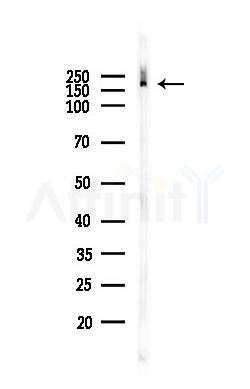 GP210 Antibody - Western blot analysis of lysates from PC12 cells(heat-shock 45min treatment), using GP210 Antibody at 1/1000 dilution.
