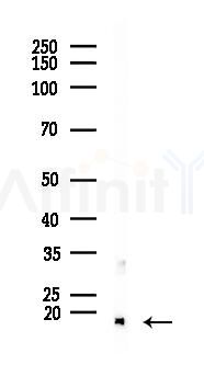 PEN2 Antibody - Western blot analysis of lysates from Rat liver, using PEN2 Antibody at 1/1000 dilution.