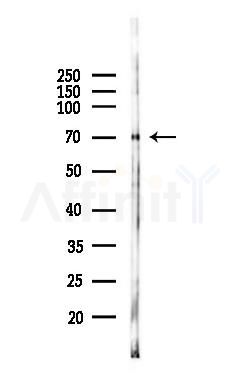 URP2 Antibody - Western blot analysis of lysates from COLO205 cells(heat-shock 45min treatment), using URP2 Antibody at 1/1000 dilution.