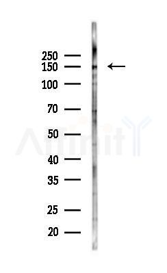 PTCH2 Antibody - Western blot analysis of lysates from COLO205 cells(heat-shock 45min treatment), using PTCH2 Antibody at 1/1000 dilution.