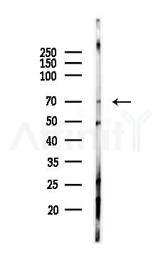 COL4A3BP Antibody - Western blot analysis of lysates from PC12 cells(heat-shock 45min treatment), using COL4A3BP Antibody at 1/1000 dilution.
