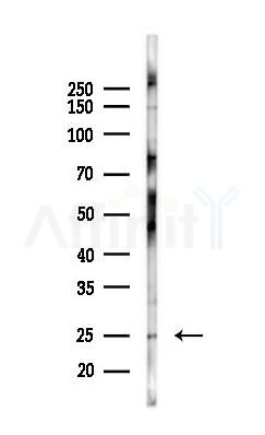 DERL2 Antibody - Western blot analysis of lysates from COLO205 cells(heat-shock 45min treatment), using DERL2 Antibody at 1/1000 dilution.