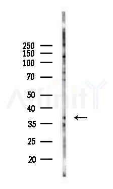 tenomodulin Antibody - Western blot analysis of lysates from COLO205 cells(heat-shock 45min treatment), using tenomodulin Antibody at 1/1000 dilution.
