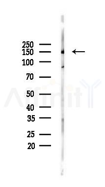 Intersectin 1 Antibody - Western blot analysis of lysates from Rat testis, using Intersectin 1 Antibody at 1/1000 dilution.