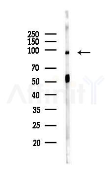 TTC7A Antibody - Western blot analysis of lysates from Rat brain, using TTC7A Antibody at 1/1000 dilution.