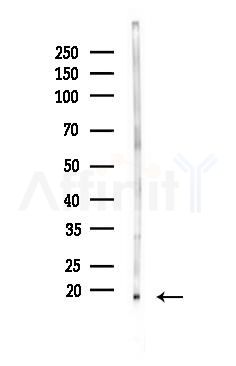 Thymosin beta 10 Antibody - Western blot analysis of lysates from Rat lung, using Thymosin beta 10 Antibody at 1/1000 dilution.