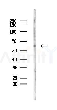PAG Antibody - Western blot analysis of lysates from 293 cells(LPS 4h treatment), using PAG Antibody at 1/1000 dilution.