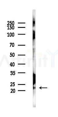 Hippocalcin Antibody - Western blot analysis of lysates from 293 cells(LPS 4h treatment), using Hippocalcin Antibody at 1/1000 dilution.