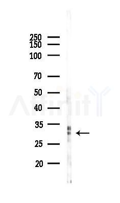 GSDMD N-Terminal Antibody(Mouse specific) - Western blot analysis of lysates from PC12 cells(starvation 24h treatment), using GSDMD N-Terminal Antibody(Mouse specific) at 1/1000 dilution.
