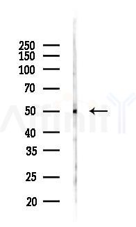 Semaphorin 3B Antibody - Western blot analysis of lysates from Mouse kidney, using Semaphorin 3B Antibody at 1/1000 dilution.