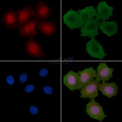 Pit1 Antibody - DF13833 staining Hela cells(30min of UV treatment) by IF/ICC.