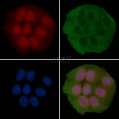 Unrip Antibody - DF13860 staining Hela cells(30min of UV treatment) by IF/ICC.