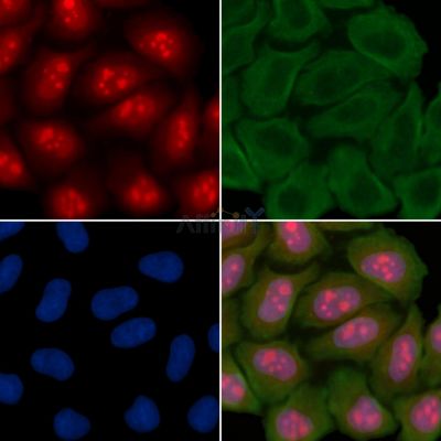 p19 INK4d Antibody - DF13861 staining Hela cells(30min of UV treatment) by IF/ICC.