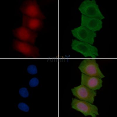 RNF8 Antibody - DF13868 staining Hela cells(30min of UV treatment) by IF/ICC.