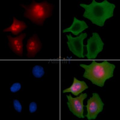 PRDM4/PFM1 Antibody - DF13901 staining Hela cells(30min of UV treatment) by IF/ICC.