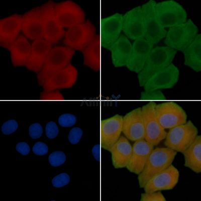 TCIRG1 Antibody - DF13909 staining Hela cells(30min of UV treatment) by IF/ICC.