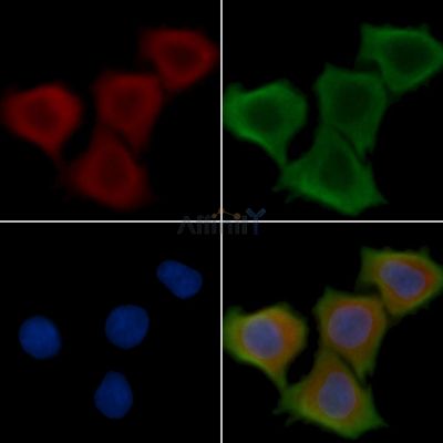 EPB41L3 Antibody - DF13923 staining Hela cells(30min of UV treatment) by IF/ICC.