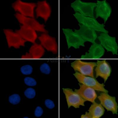 ST6GALNAC1 Antibody - DF14094 staining Hela cells(45min of heat-shock treatment) by IF/ICC.