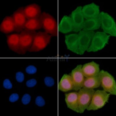 TARSL2 Antibody - DF14136 staining Hela cells(30min of UV treatment) by IF/ICC.