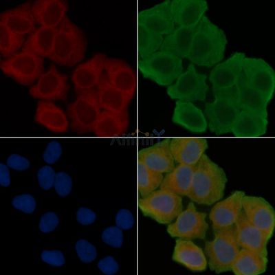 CMG1 Antibody - DF14146 staining Hela cells(30min of UV treatment) by IF/ICC.