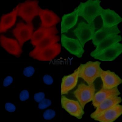 ATAD3A Antibody - DF14240 staining Hela cells(30min of UV treatment) by IF/ICC.