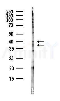 TID1 Antibody - Western blot analysis of lysates from Hela cells(heat-shock,45min treatment), using TID1 Antibody at 1/1000 dilution.