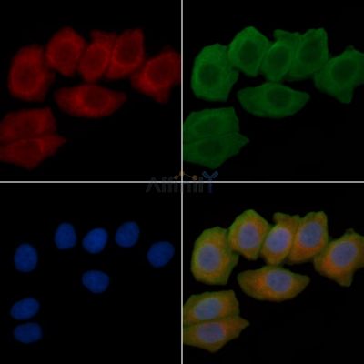 Transglutaminase 7 Antibody - DF14370 staining Hela cells(30min of UV treatment) by IF/ICC.