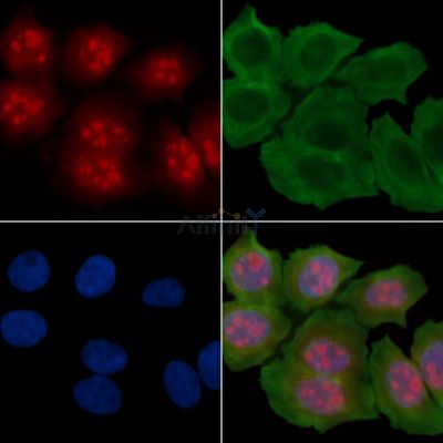 RSL1D1 Antibody - DF14381 staining Hela cells(30min of UV treatment) by IF/ICC.