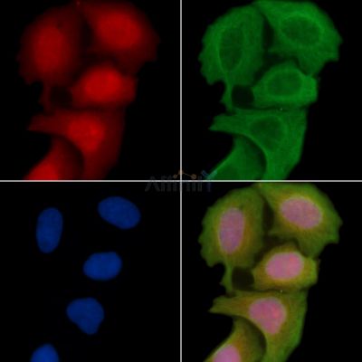 SPNXA Antibody - DF14385 staining Hela cells(30min of UV treatment) by IF/ICC.