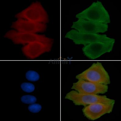 KCNAB1 Antibody - DF14517 staining Hela cells(30min of UV treatment) by IF/ICC.
