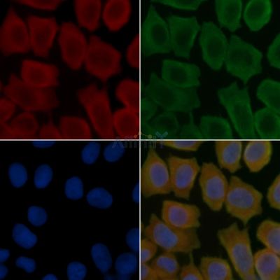 SLC43A3 Antibody - DF14600 staining Hela cells(45min of heat-shock treatment) by IF/ICC.