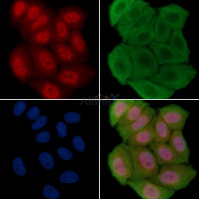 MYO1C Antibody - DF14647 staining Hela cells(30min of UV treatment) by IF/ICC.
