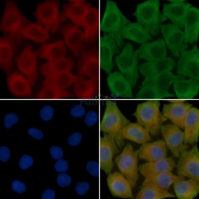 KCNJ12 Antibody - DF14762 staining Hela cells(30min of UV treatment) by IF/ICC.