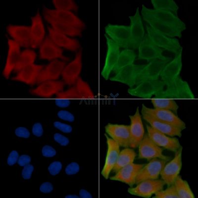 AP1G2 Antibody - DF15085 staining Hela cells(45min of heat-shock treatment) by IF/ICC.