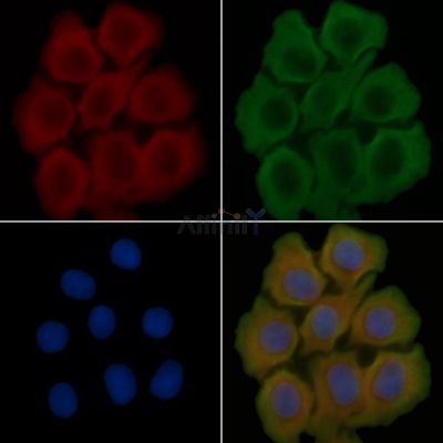 GSG1L Antibody - DF15101 staining Hela cells(45min of heat-shock treatment) by IF/ICC.