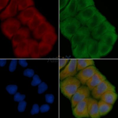 BFSP2 Antibody - DF15187 staining Hela cells(45min of heat-shock treatment) by IF/ICC.