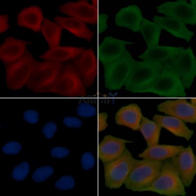 PPTC7 Antibody - DF15198 staining Hela cells(45min of heat-shock treatment) by IF/ICC.