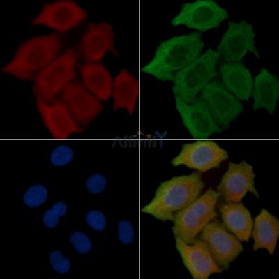 APTX Antibody - DF15347 staining Hela cells(30min of UV treatment) by IF/ICC.