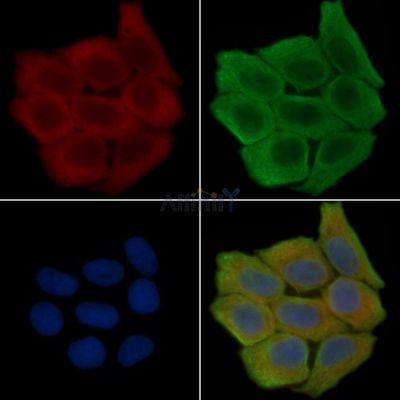 CRIP2 Antibody - DF15494 staining Hela cells(30min of UV treatment) by IF/ICC.