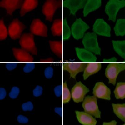 CSPS Antibody - DF15553 staining Hela cells(30min of UV treatment) by IF/ICC.