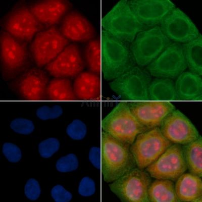 TFAP2E Antibody - DF15650 staining Hela cells(30min of UV treatment) by IF/ICC.