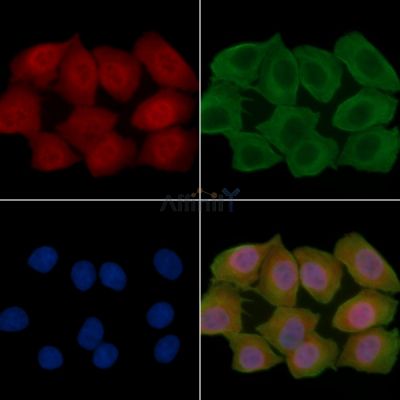 UBTD1 Antibody - DF15663 staining Hela cells(30min of UV treatment) by IF/ICC.