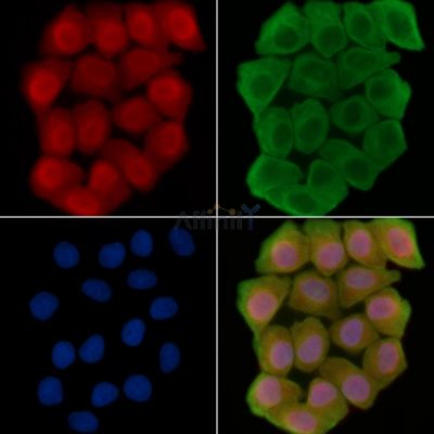 DTX3L Antibody - DF15713 staining Hela cells(30min of UV treatment) by IF/ICC.