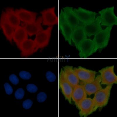TMEM187 Antibody - DF15804 staining Hela cells(30min of UV treatment) by IF/ICC.