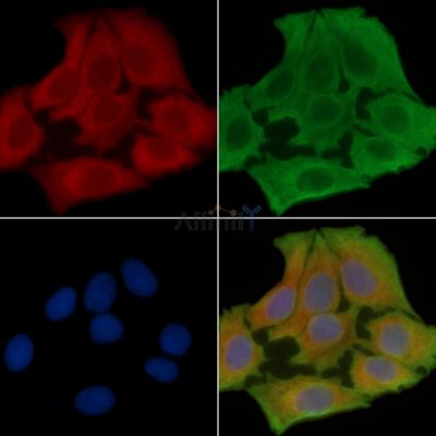 ENTPD7 Antibody - DF15822 staining Hela cells(30min of UV treatment) by IF/ICC.