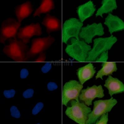 RNASEH2A Antibody - DF15877 staining Hela cells(30min of UV treatment) by IF/ICC.