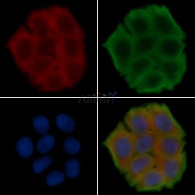 TSPAN2 Antibody - DF15896 staining Hela cells(30min of UV treatment) by IF/ICC.