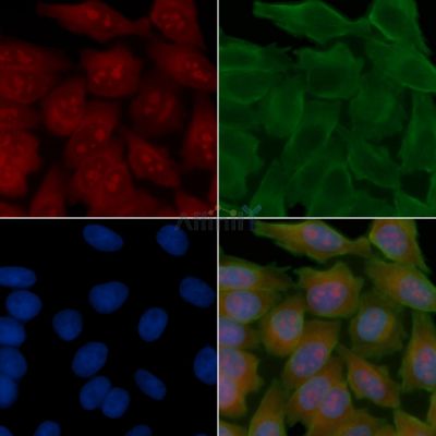 POU6F2 Antibody - DF15946 staining Hela cells(45min of heat-shock treatment) by IF/ICC.